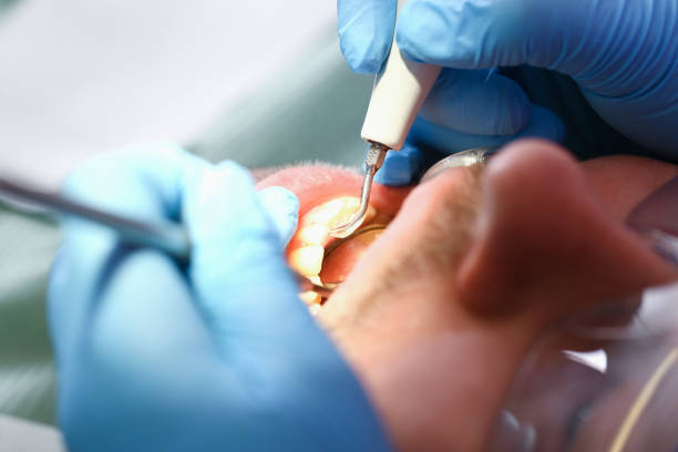 Best Emergency Orthodontic Repairs in Mountain View, CA