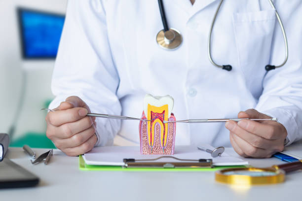 Best Emergency Wisdom Tooth Extraction in Mountain View, CA